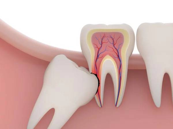 Nằm mơ thấy đi nhổ răng Nằm mơ thấy đi nhổ răng